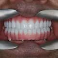 Digital Dental Implants-ddentalimplants
