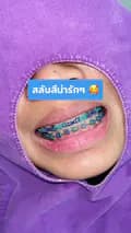 Toothcamp ทำฟันกรุงเทพ นนทบุรี-toothcamp